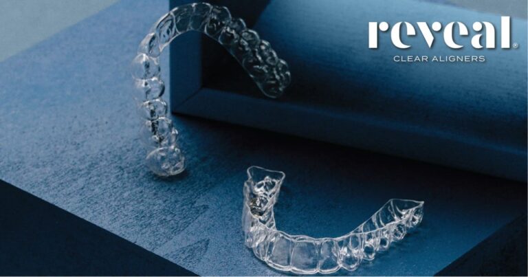 Clear Aligner Therapy
